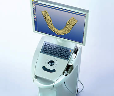 Cerec Aventura